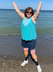 Wendy Wallace standing on the beach with her arms raised overhead. She shows off her quadriplegic arms and legs after having victory over a flesh-eating bacteria that tried to take her life